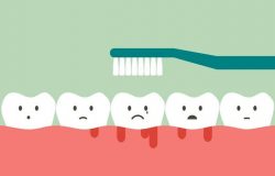 10 nguyên nhân gây chảy máu nướu răng bạn cần biết