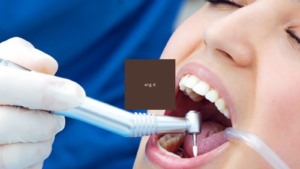 Khám răng định kỳ để giúp chăm sóc răng miệng tốt hơn